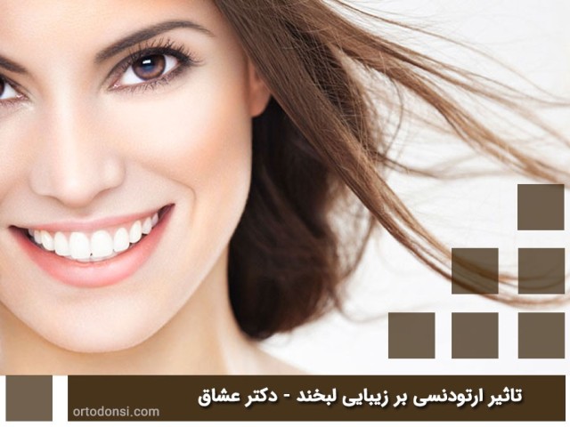 The-effect-of-orthodontics-on-the-beauty-of-a-smile