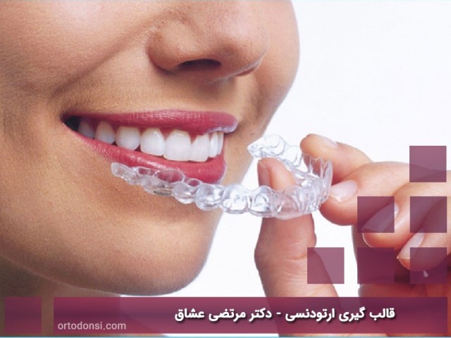 Orthodontic-molding