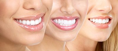 آیا درمان ارتدنسی می تواند باعث کج شدن ریشه ی دندانهای عقل شوند؟