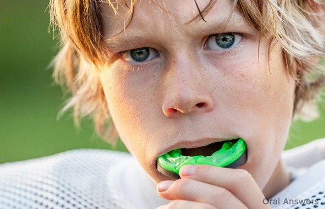 کدام نوع محافظ دهان برای کودکان مناسب تر است؟