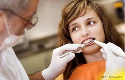 آیا دندانپزشک عمومی، میتواند درمان براکت انجام دهد؟