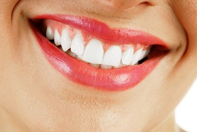 بستن فاصله بین دندانها با روش باندینگ