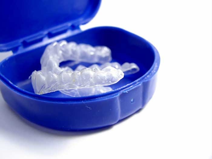 b2ap3_large_Orthodontic-braces-retainer-in-blue-case نگهدارنده ارتودنسی یا ریتینر چیست؟ 