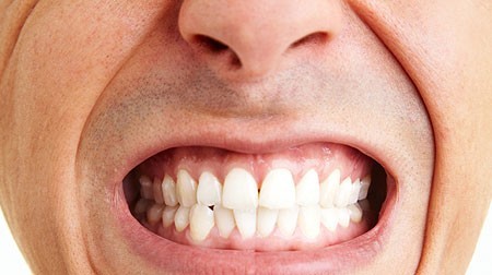 b2ap3_large__20180514-063610_1 راه‌های پیشگیری از نیاز به روکش کردن دندان