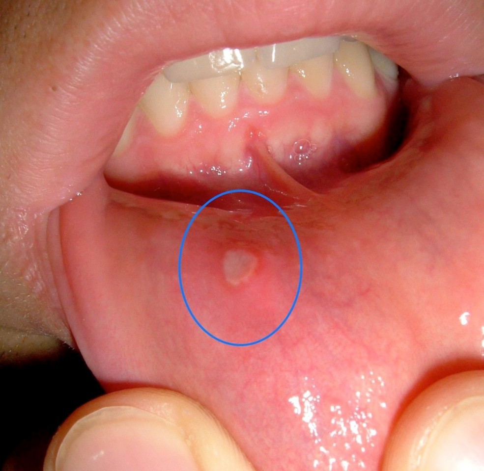 b2ap3_large_ortodonsi4 مشکلات دهان و دندان در بیماری سلیاک