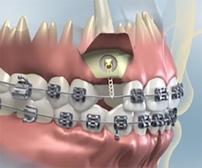 ortodonsi1
