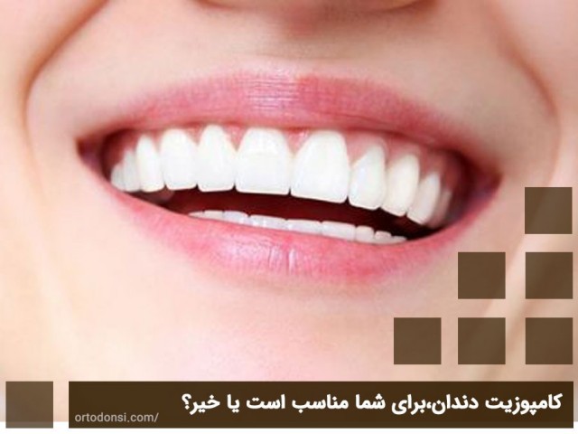 کامپوزیت دندان،برای شما مناسب است یا خیر؟ 