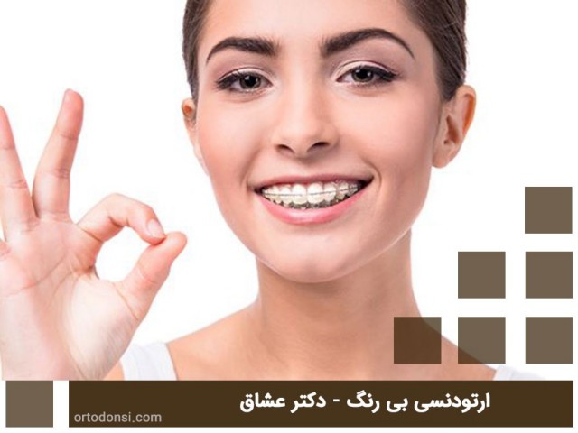 Colorless-orthodontics