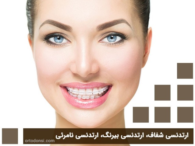 Clear-orthodontics-colorless-orthodontics-invisible-orthodontics