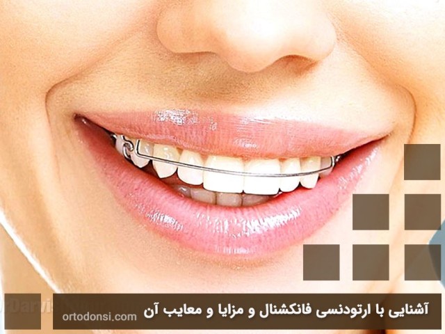 Functional-orthodontics