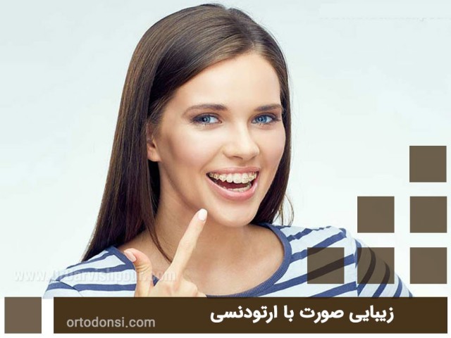 Facial-beauty-with-orthodontics