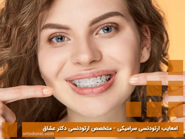 Disadvantages-of-ceramic-orthodontics