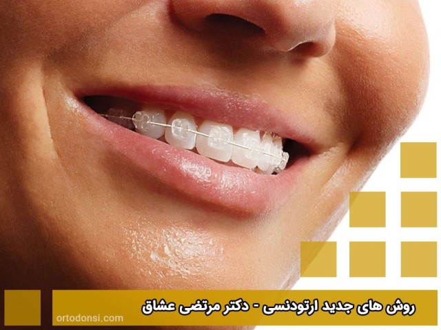 New-orthodontic-procedures
