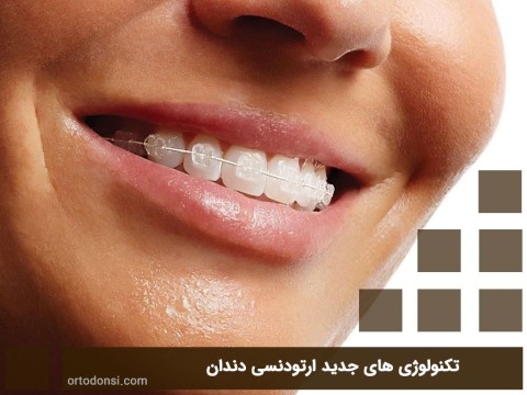New-dental-orthodontic-technologies