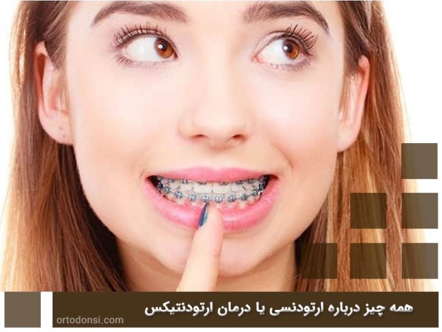 Orthodontics-or-orthodontic-treatment