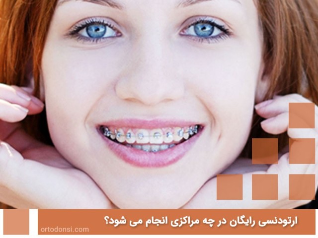 Free-orthodontics