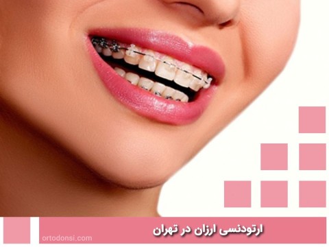 Cheap-orthodontics-in-Tehran