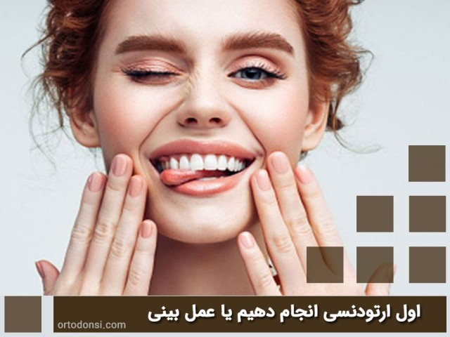 Do-orthodontics-first-or-nose-surgery