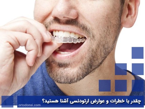 How-familiar-are-you-with-the-risks-and-complications-of-orthodontics