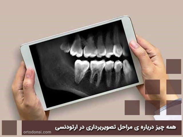 Imaging-in-orthodontics
