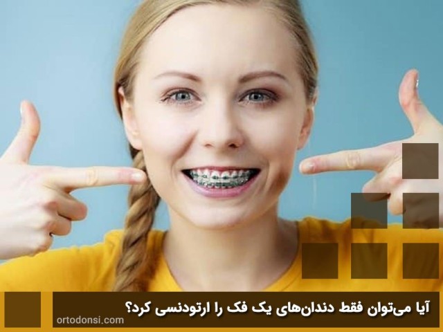 Can-only-the-teeth-of-one-jaw-be-orthodontized