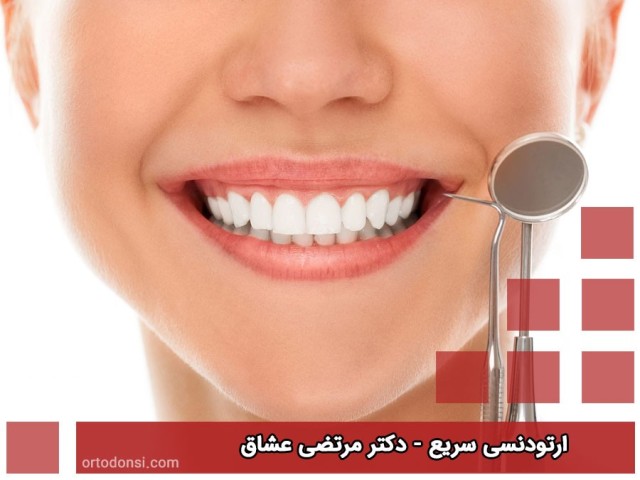 Rapid-orthodontics