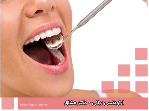 Lingual-orthodontic_20221125-063518_1