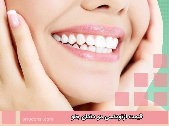 Orthodontic-price-of-two-front-teeth