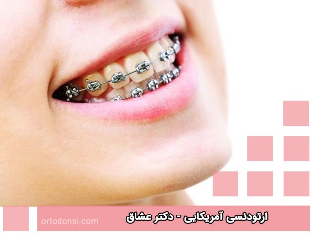 American-orthodontics