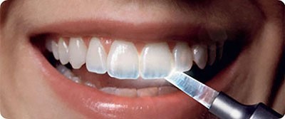 b2ap3_thumbnail_minaye-dandan7 علائم از بین رفتن مینای دندان و درمانهای آن