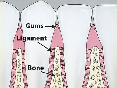 b2ap3_thumbnail_ortodonsi23 در درمان ارتودنسی چگونه دندان حرکت می کند؟