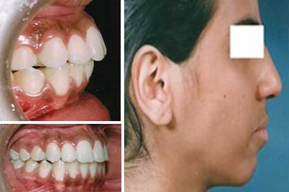 نمونه ارتودنسی